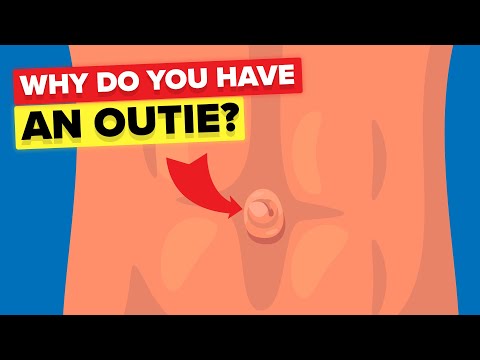Outie Belly Button Videos